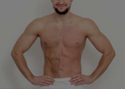 Épilations homme